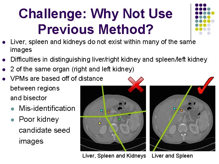 Challenge: Why Not Use Previous Method? l l Liver, spleen and kidneys do not