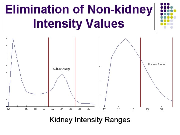 Elimination of Non-kidney Intensity Values Kidney Intensity Ranges 
