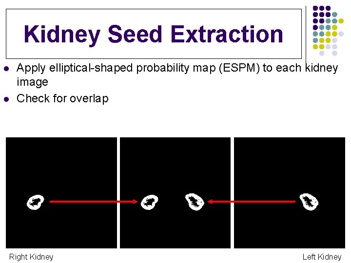 Kidney Seed Extraction l l Apply elliptical-shaped probability map (ESPM) to each kidney image