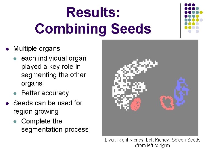 Results: Combining Seeds l l Multiple organs l each individual organ played a key