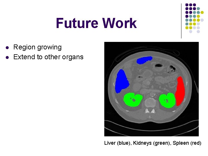 Future Work l l Region growing Extend to other organs Liver (blue), Kidneys (green),