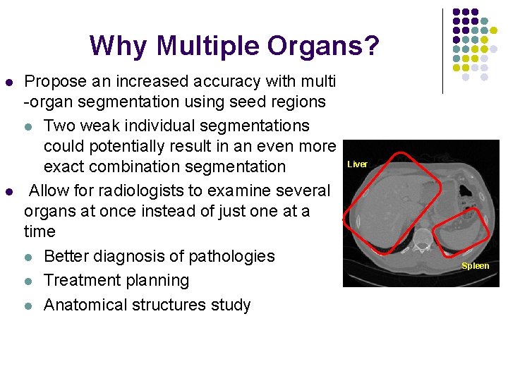 Why Multiple Organs? l l Propose an increased accuracy with multi -organ segmentation using
