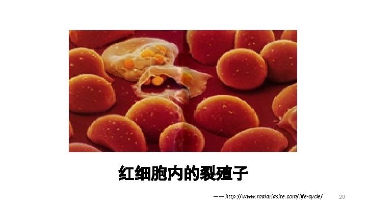 红细胞内的裂殖子 —— http: //www. malariasite. com/life-cycle/ 20 