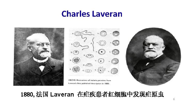 Charles Laveran 1880, 法国 Laveran 在疟疾患者红细胞中发现疟原虫 6 