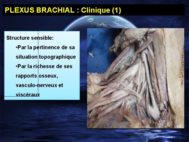 PLEXUS BRACHIAL : Clinique (1) Structure sensible: • Par la pertinence de sa situation