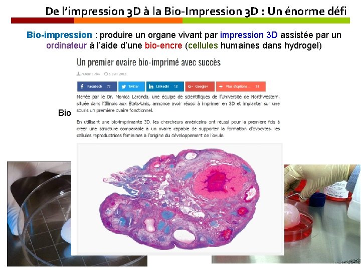 De l’impression 3 D à la Bio-Impression 3 D : Un énorme défi Bio-impression
