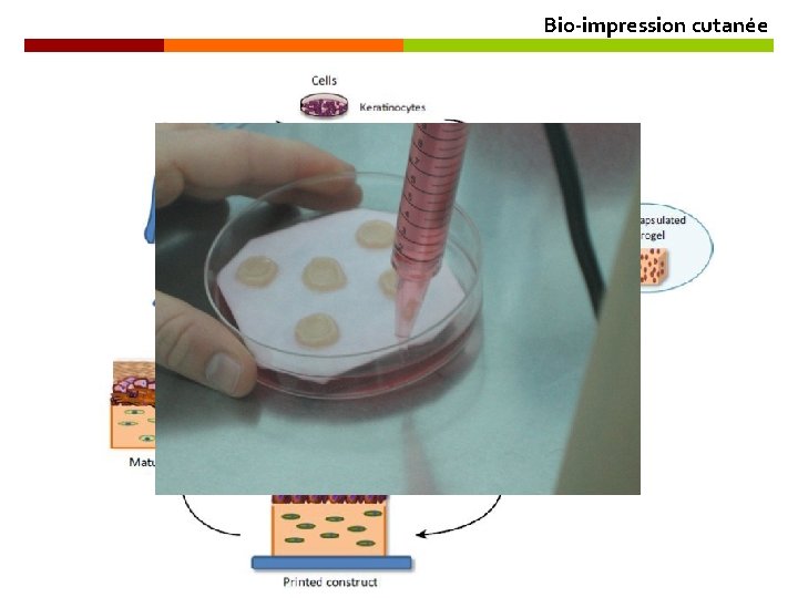Bio-impression cutanée OPTIMISER LES MODELES D’ETUDE DE L’HUMAIN POUR 
