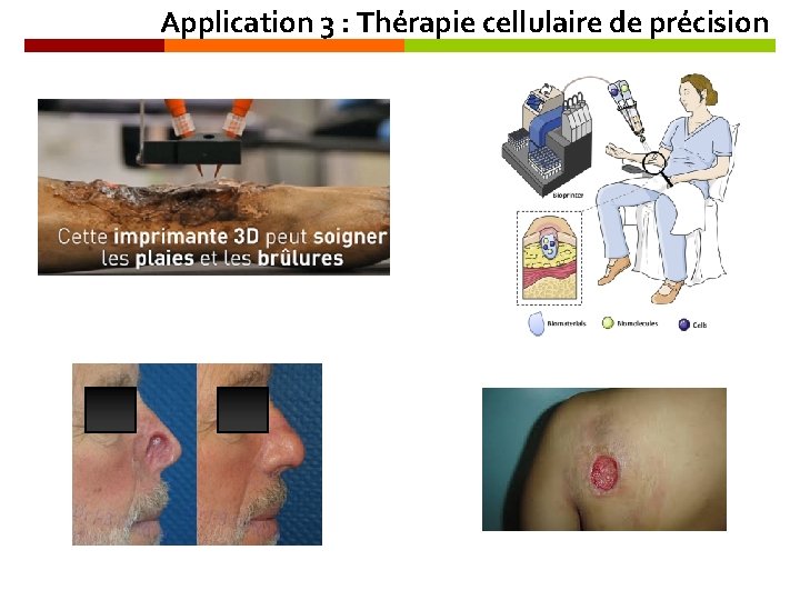 Application 3 : Thérapie cellulaire de précision 