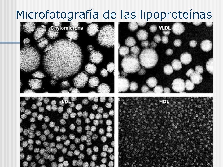 Microfotografía de las lipoproteínas 