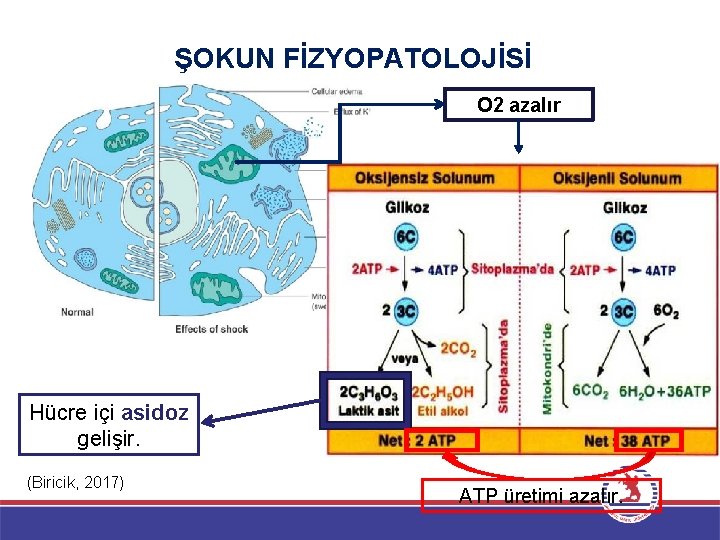 ŞOKUN FİZYOPATOLOJİSİ O 2 azalır Hücre içi asidoz gelişir. (Biricik, 2017) ATP üretimi azalır.