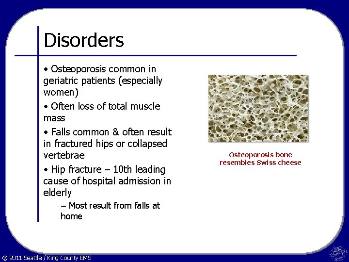 Disorders • Osteoporosis common in geriatric patients (especially women) • Often loss of total