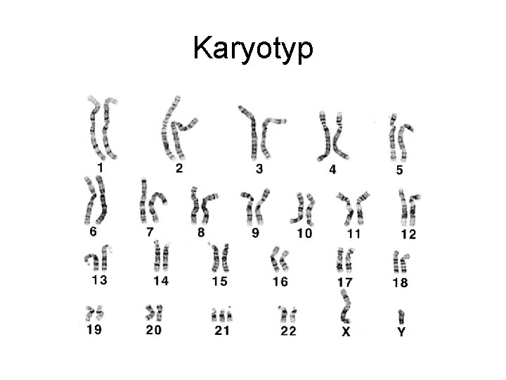 Karyotyp 