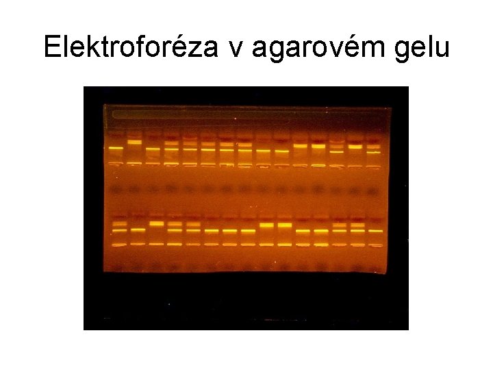 Elektroforéza v agarovém gelu 