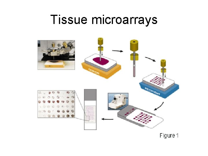 Tissue microarrays 