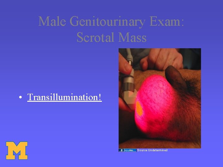 Male Genitourinary Exam: Scrotal Mass • Transillumination! Source Undetermined 