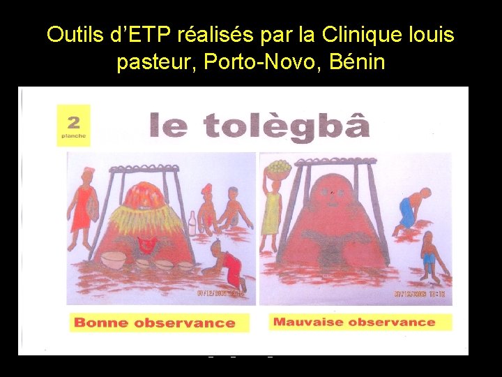 Outils d’ETP réalisés par la Clinique louis pasteur, Porto-Novo, Bénin DIU_VIH_Burundi_Juin 2013 23 