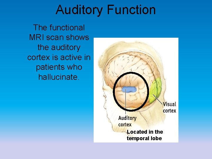 Auditory Function The functional MRI scan shows the auditory cortex is active in patients