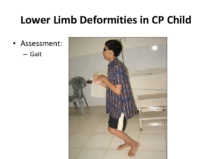 Lower Limb Deformities in CP Child • Assessment: – Gait 