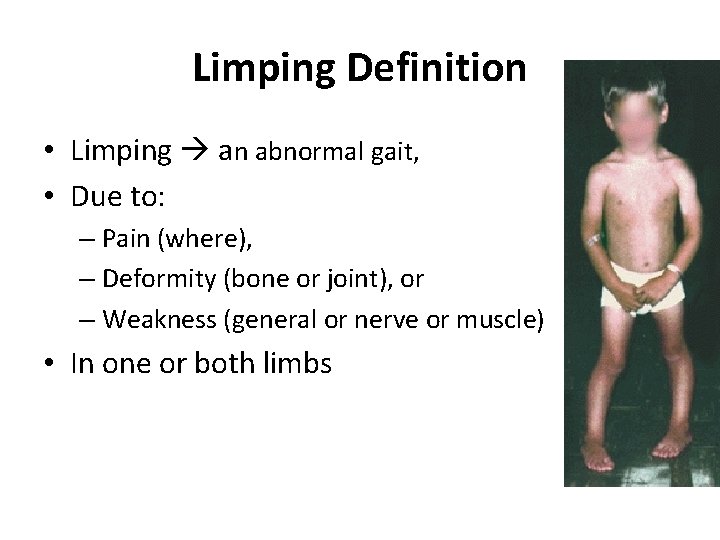 Limping Definition • Limping an abnormal gait, • Due to: – Pain (where), –