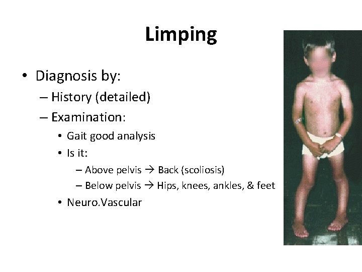 Limping • Diagnosis by: – History (detailed) – Examination: • Gait good analysis •