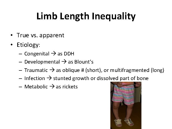 Limb Length Inequality • True vs. apparent • Etiology: – – – Congenital as