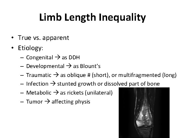 Limb Length Inequality • True vs. apparent • Etiology: – – – Congenital as