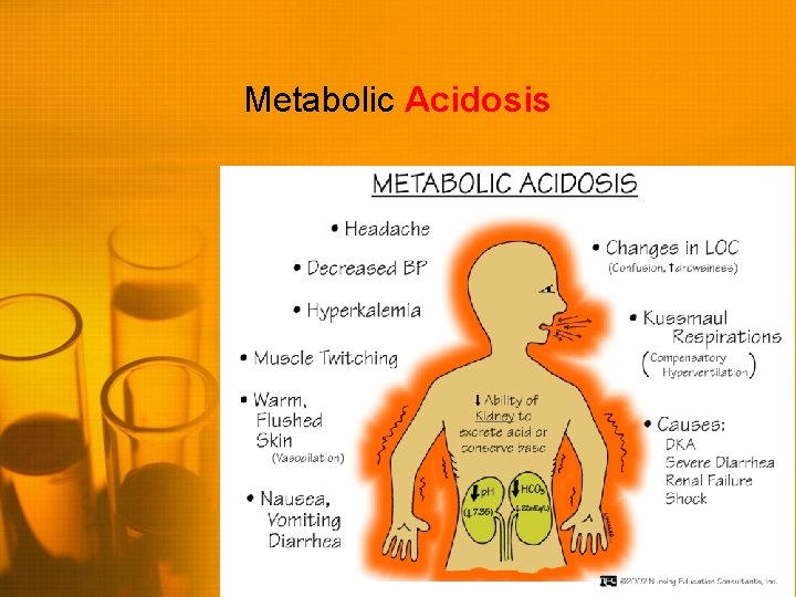 Metabolic Acidosis 