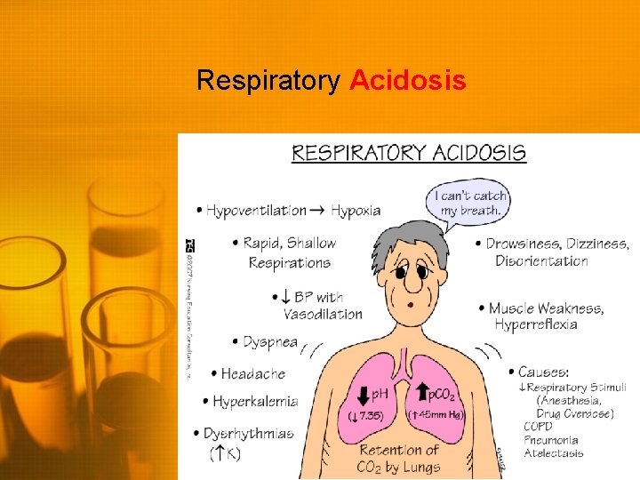 Respiratory Acidosis 