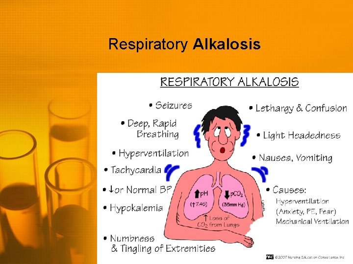 Respiratory Alkalosis 