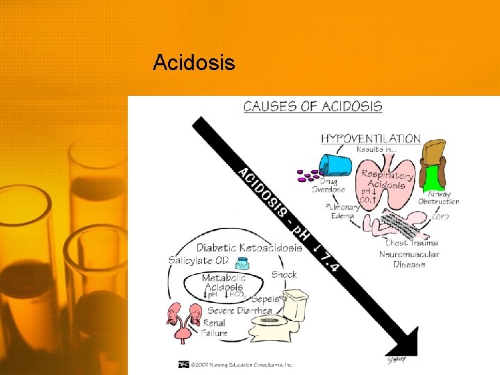 Acidosis 