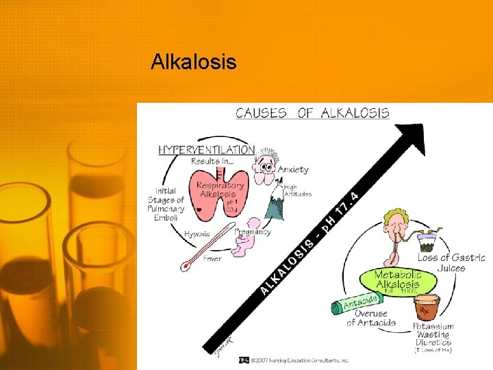 Alkalosis 
