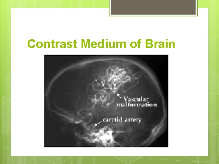 Contrast Medium of Brain 