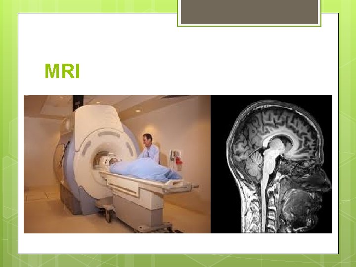 MRI 