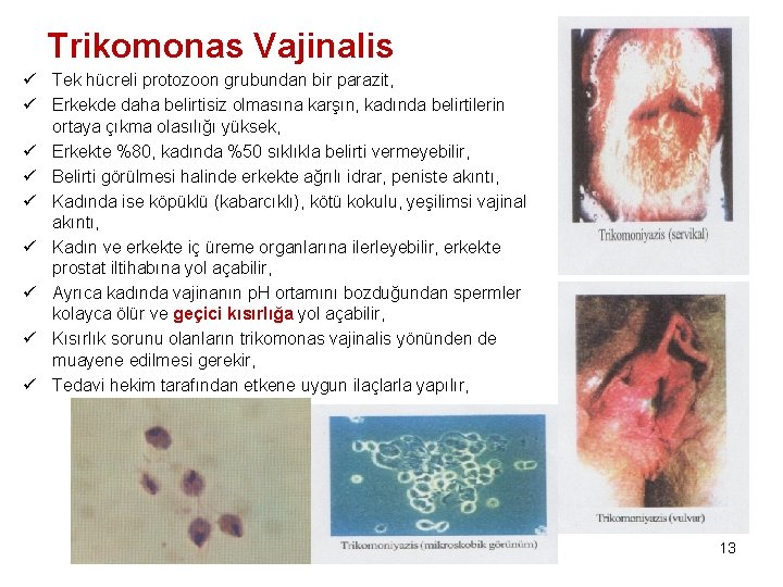 Trikomonas Vajinalis ü Tek hücreli protozoon grubundan bir parazit, ü Erkekde daha belirtisiz olmasına