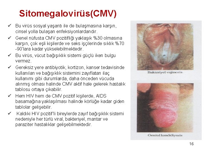 Sitomegalovirüs(CMV) ü Bu virüs sosyal yaşantı ile de bulaşmasına karşın, cinsel yolla bulaşan enfeksiyonlardandır.
