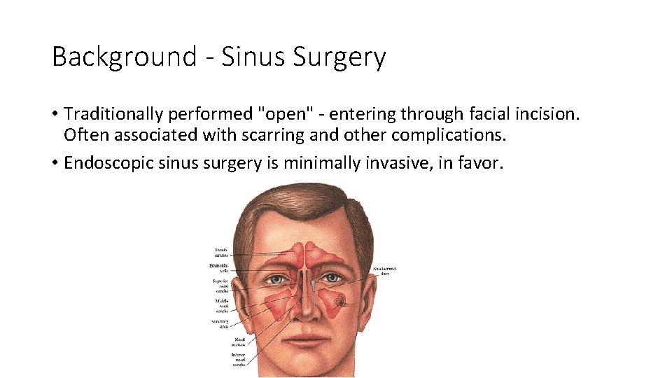 Background - Sinus Surgery • Traditionally performed "open" - entering through facial incision. Often Background - Sinus Surgery • Traditionally performed "open" - entering through facial incision. Often