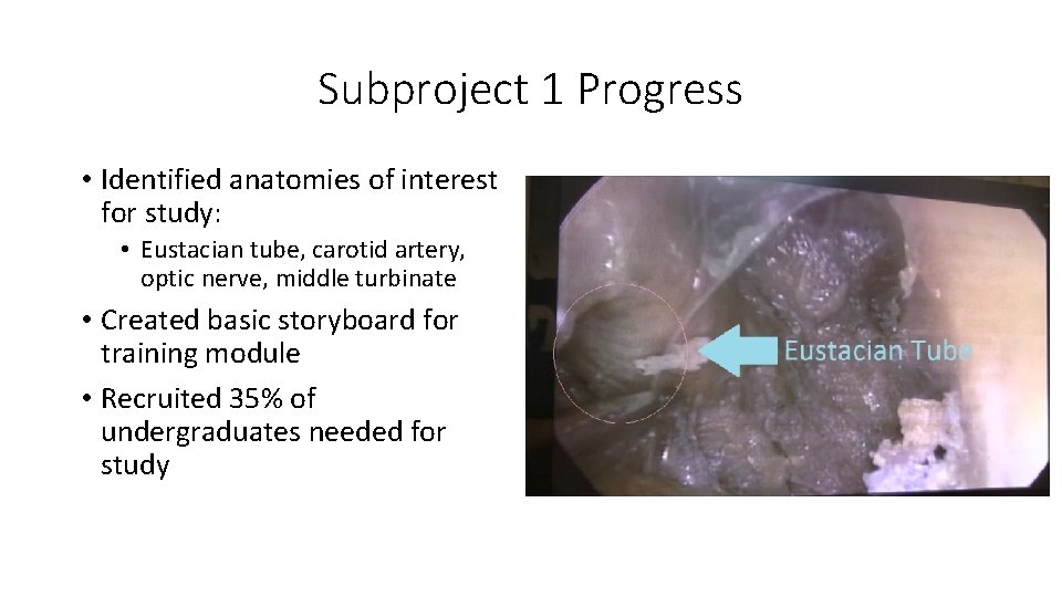 Subproject 1 Progress • Identified anatomies of interest for study: • Eustacian tube, carotid Subproject 1 Progress • Identified anatomies of interest for study: • Eustacian tube, carotid