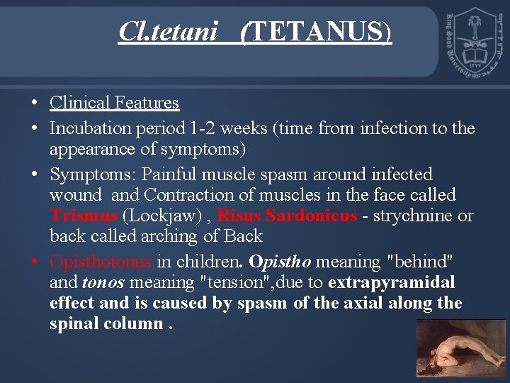 Cl. tetani (TETANUS) • Clinical Features • Incubation period 1 -2 weeks (time from