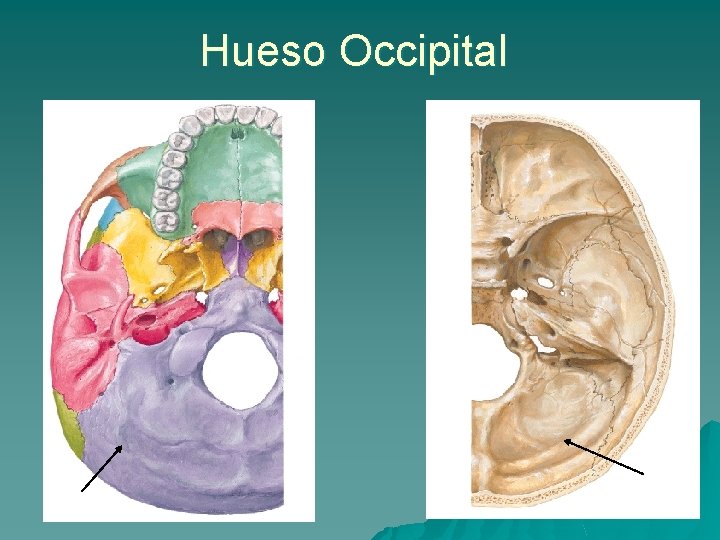 Hueso Occipital 