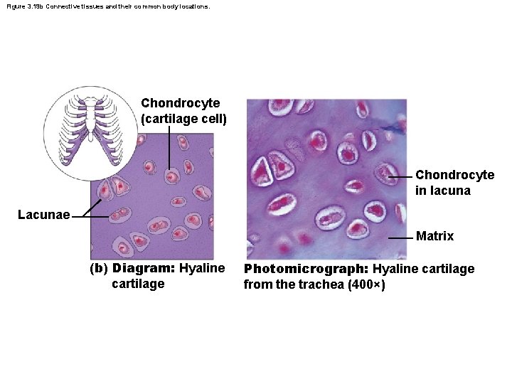 Figure 3. 19 b Connective tissues and their common body locations. Chondrocyte (cartilage cell)