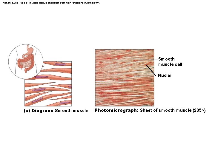 Figure 3. 20 c Type of muscle tissue and their common locations in the