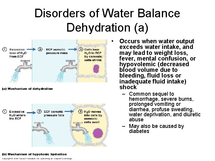 Disorders of Water Balance Dehydration (a) • Occurs when water output exceeds water intake,