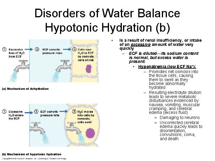 Disorders of Water Balance Hypotonic Hydration (b) • Is a result of renal insufficiency,