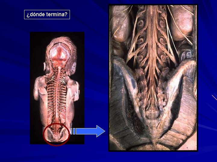 ¿dónde termina? 