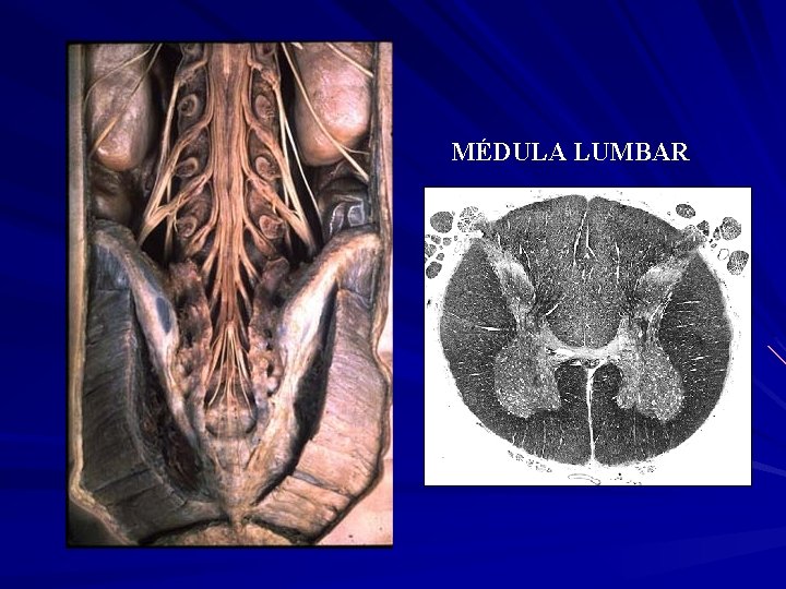 MÉDULA LUMBAR 