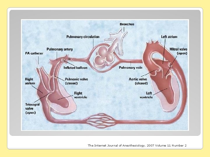 The Internet Journal of Anesthesiology. 2007 Volume 11 Number 2 