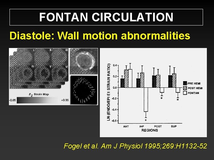 FONTAN CIRCULATION Diastole: Wall motion abnormalities Fogel et al. Am J Physiol 1995; 269: