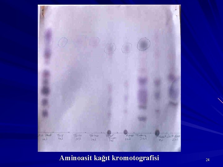 Aminoasit kağıt kromotografisi 24 