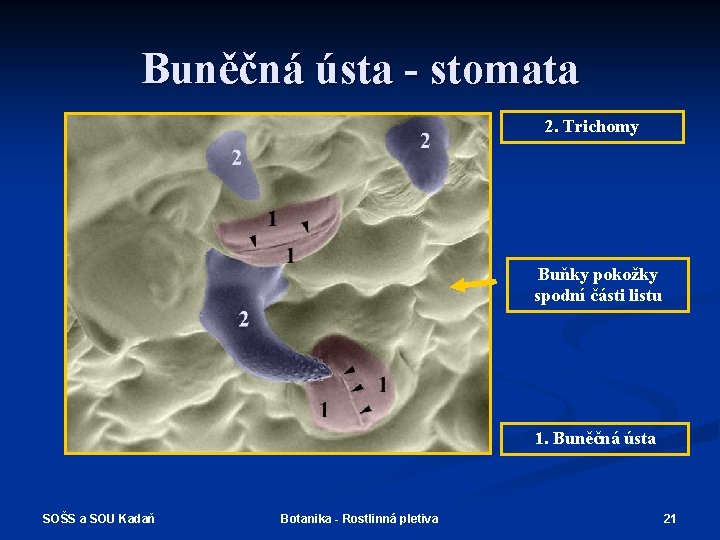 Buněčná ústa - stomata 2. Trichomy Buňky pokožky spodní části listu 1. Buněčná ústa