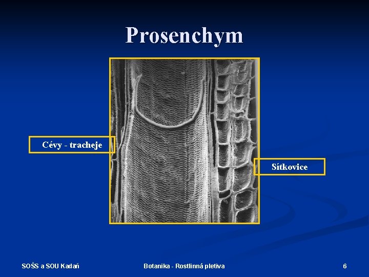 Prosenchym Cévy - tracheje Sítkovice SOŠS a SOU Kadaň Botanika - Rostlinná pletiva 6